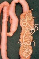 spoelwormen in dunne darm